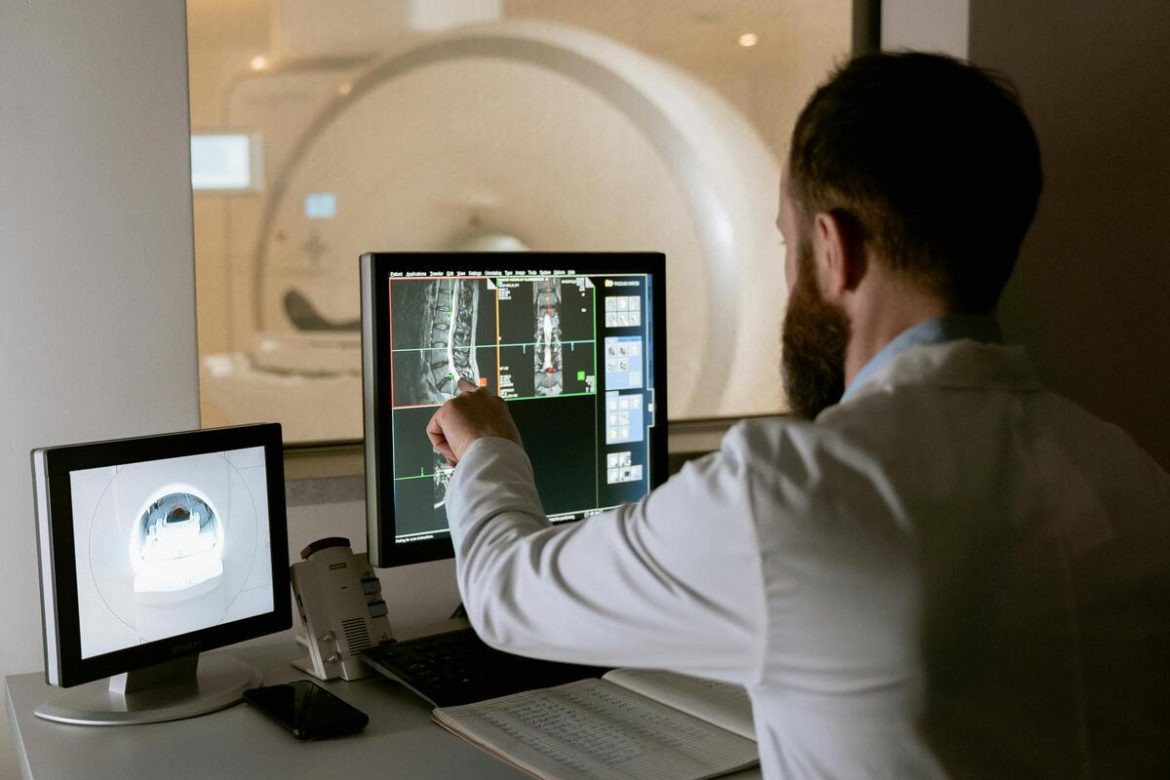 AI-Powered MRI Scans Enhance Early MS Detection