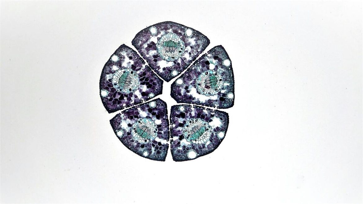 Stem Cell Therapy in MS Enters Global Multicenter Trials